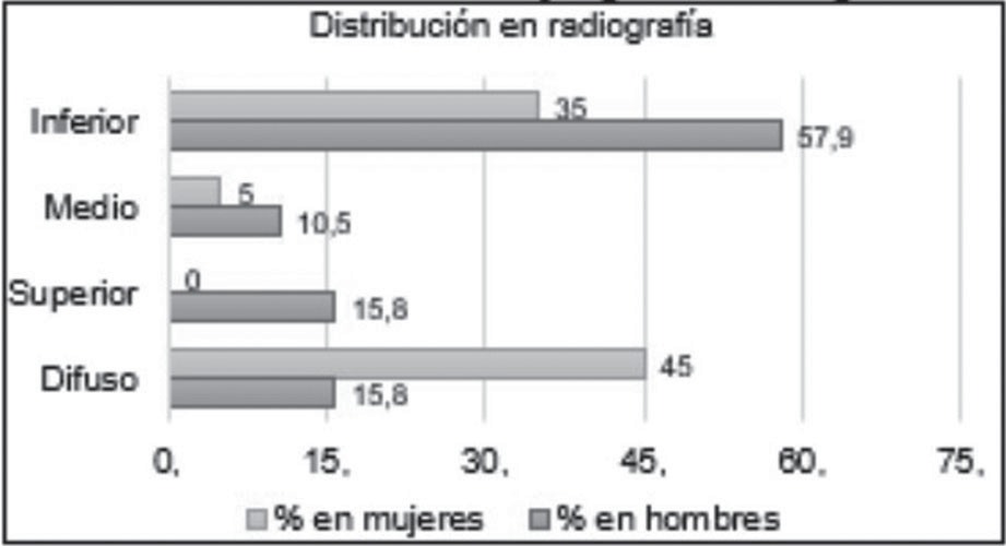 Distribución de las anormalidades por género en radiografía.